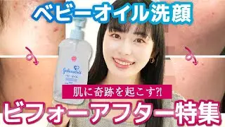 【劇的変化!】「ベビーオイル洗顔」ビフォーアフターを提唱者mimiが解説