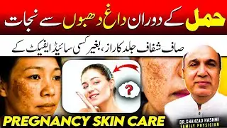  Pregnancy Melasma | Causes, Symptoms & Best Treatment for Dark Patches on Face| Dr. Shahzad Hashmi