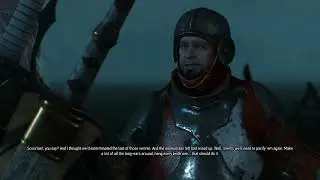 Geralt snake eyes! Cat eyes! :D HAZEL!! NOT BLUE!!!
