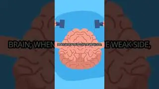 Expressive Language Treatment Techniques for Aphasia! #cilt #aphasia #shorts    #facts #slpxaud