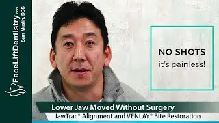 Lower Jaw Repositioned without Surgery using JawTrac&reg; Alignment and VENLAY&reg; Restorations