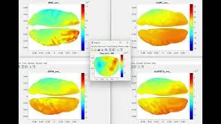 Unconstrained dipoles. Brain activity reconstructed from MEG recordings using four methods.