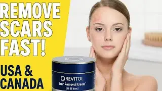 Best Scar Removal Cream in USA & Canada | Revitol Real Results Review | Old Scars Gone!