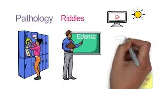Edema Pathophysiology Part - 1: Definition Physiology of Microcirculation | How Does Edema Occur ? |