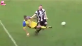 Worst Broken Leg Injuries in Football History | Terrible | Football Fight