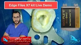 Edge Files X7 KIT Demo (ep 8 )