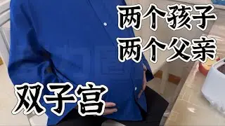 孕夫出轨怀胎回家，两个子宫两个孩子两个爸爸（憋生、推胎头）谁的孩子先出生？