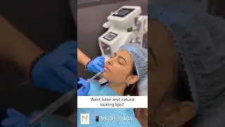 Lip Filler Treatment at Nirvana Clinic | Call 99200 33404