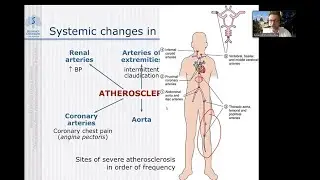 Internal disease propedeutics : Ischemic heart disease. Coronary syndromes
