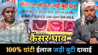 कैंसर घाव का 100% ग्रांटी ईलाज👍जड़ी बुटी दावाई🙏मंगल हेम्ब्रम दारसुड़ी पाकुड़ झारखंड संपर्क9113779733