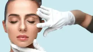 Blepharoplasty (Unisex) - Cosmetic Procedure (Subliminal Audio)