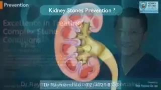 How to Prevent Kidney Stones ?