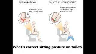 How toilet posture affects your health