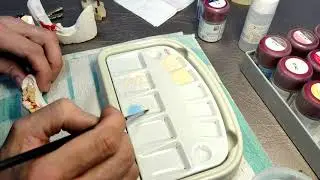 Нанесение дентина и массы режущего края