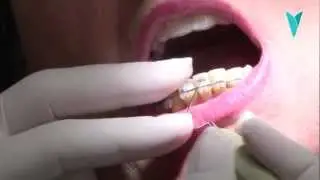 Clínica dental Cuevas Queipo - Ayer y hoy: La Ortodoncia