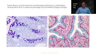 PAS special stain | Histo-techniques | MD Pathology | Practical | Viva | GAME | RATS | Dr GSS | SRM