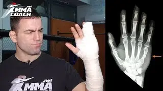 Should you train while injured?