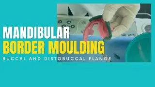 MANDIBULAR BORDER MOULDING - BUCCAL FLANGE AND DISTOBUCCAL AREA