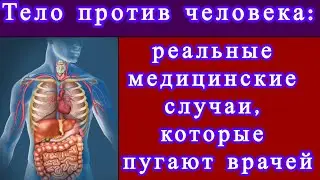 Реальные медицинские случаи, которые пугают врачей #медицинские загадки, #странные случаи
