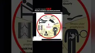 Most repited PYQ VAP for norcet all nursing exam ||#ytshorts #shorts #norcet #nursingofficer #sgpgi