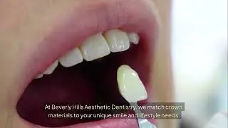 What are the different types of dental crown materials? Beverly Hills CA