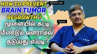 மூளையில் கட்டி மீண்டும் வளராமல் தடுப்பது எப்படி?How to prevent Brain tumor Regrowth?Dr.Roopesh Kumar