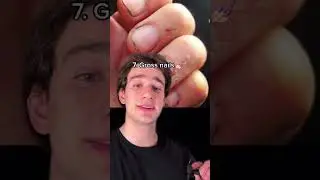 Biggest turn-off&rsquo;s of 2021!🤢#top10#turnoff#relationships IB: @dylanpage.ning