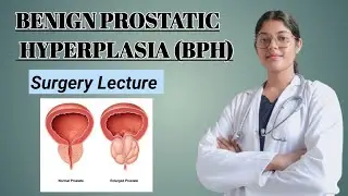 Enlarged Prostate Gland (BPH)|| Causes, Symptoms, Diagnosis, Treatment, Complications| #Dr. Shweta 