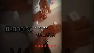 #samples #collection #samplecollection #medicalstudent #samplesource #love #lovestatus