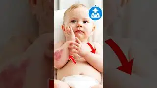 Постоянный зуд у младенцев | Когда следует обратиться к врачу #baby