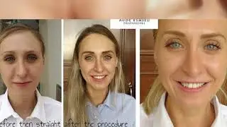 Semi-Permanent Makeup - Transform Your Look at Vilafortuny, Dubai