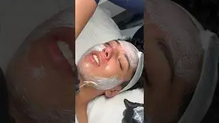 Facial Treatment on Acne-Prone Skin 🧖🏽&zwj;♀️👀☺️ #skincare #shorts