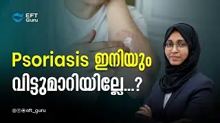 Psoriasis ഇനിയും വിട്ടുമാറിയില്ലേ...?| Life Transformation Training | EFT GURU