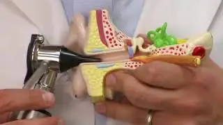 Removing Impacted Ear Wax