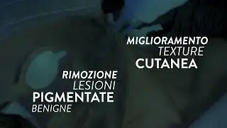 Xlase Plus: i migliori laser in un’unica piattaforma!