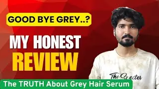 My Grey Hair Battle: Did Bare Anatomy Anti Hair Grey Serum Win?