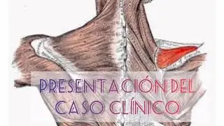TENDINOPATÍAS DEL SUPRAESPINOSO