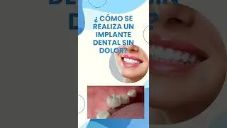 C&Oacute;MO SE REALIZA UN IMPLANTE DENTAL SIN DOLOR