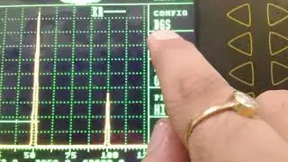 DGS Calibration using Backwall Echo