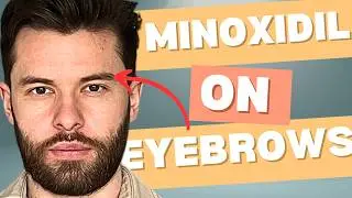 Eyebrows Growth Secrets: How to Apply Minoxidil on Eyebrows for Fuller Brows | Step-by-Step Guide