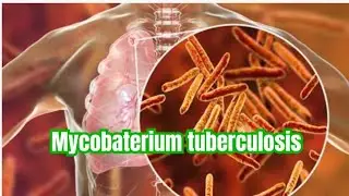 introduction of mycobaterium tuberculosis part 1