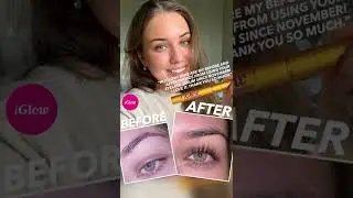 Yups. These are Rachel's lashes before and after she's been using the iGlow Lash Serum.
