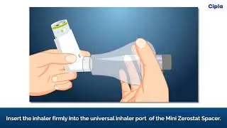 Instructions To Use Mini Zerostat Spacer