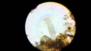 Bdelloid (Rotifer)