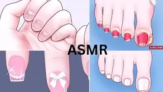 [ASMR] Biting Nails Recovery Animation|ASMR satisfying Animation