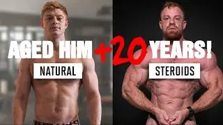 Steroids Aged Him 20 Years Permanently