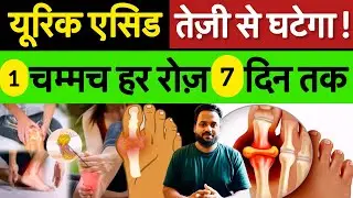 Uric Acid Control Ka Secret Formula &ndash; Without Medicine!