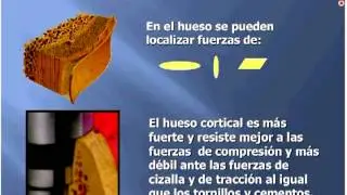 024 Biomecánica, ciencia que hace exitosa la Rehabilitación Protésica