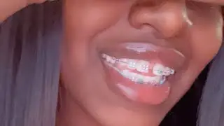 How to use teeth glue for fake braces