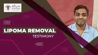 A Happy Patient from Bangladesh, Testimonials about Multiple Lipomas Removal Surgery by Dr. Doshi